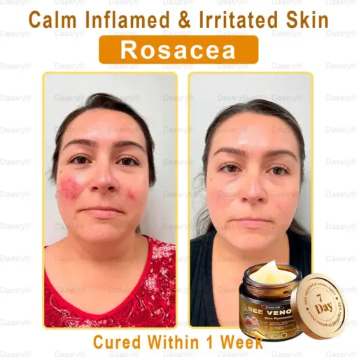 Daasry® All-in-One Skin Cream