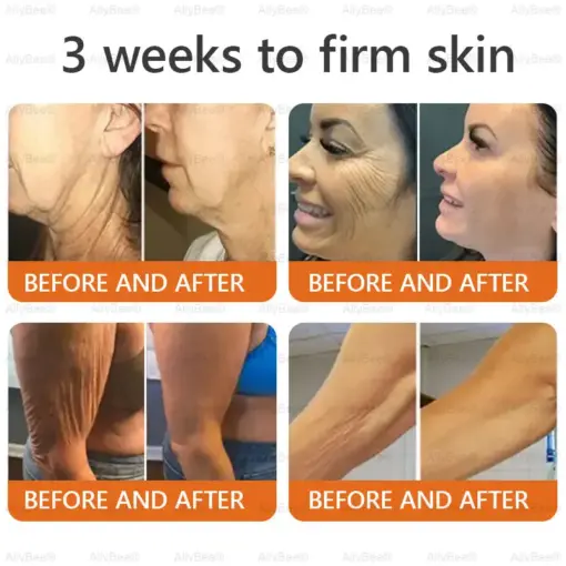 Daasry® Bee Venom Skin Cream