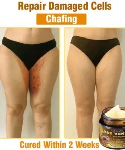 Daasry® Skin Treatment Cream