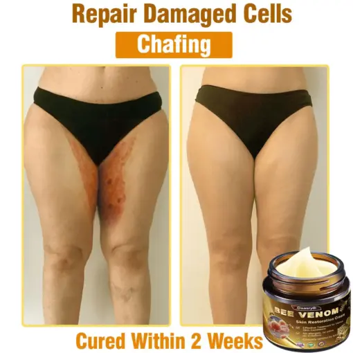 Daasry® Skin Treatment Cream