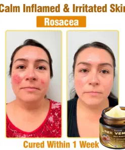 Daasry® Skin Treatment Cream
