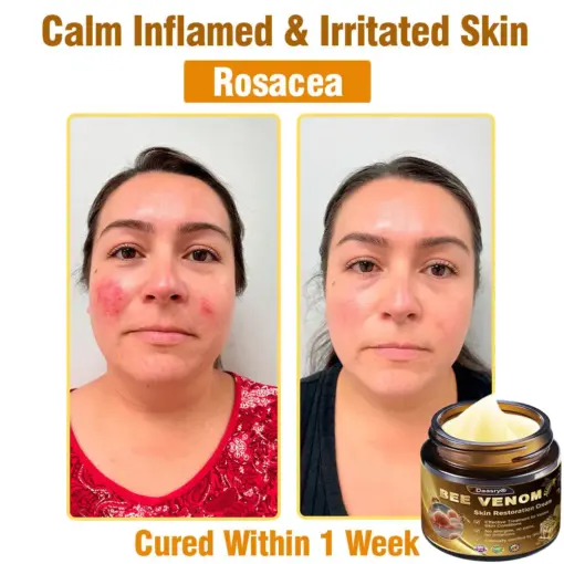 Daasry® Skin Treatment Cream