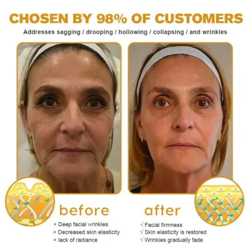 Daasry® Skin Treatment Cream