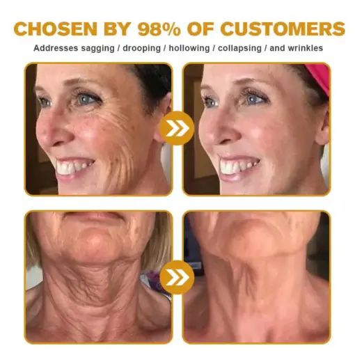 Daasry® Skin Treatment Cream
