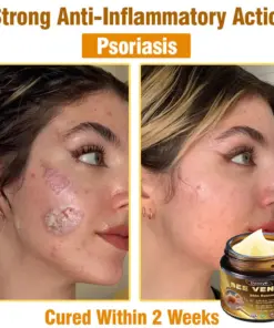 Daasry® Skin Treatment Cream