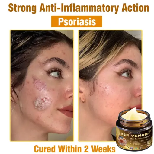 Daasry® Skin Treatment Cream