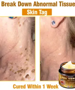 Daasry® Skin Treatment Cream