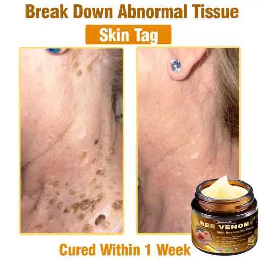 Daasry® Skin Treatment Cream