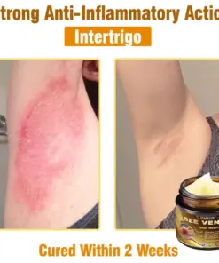 Daasry® Skin Treatment Cream