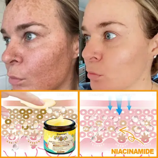 Daasry® Bee Venom Treatment Cream