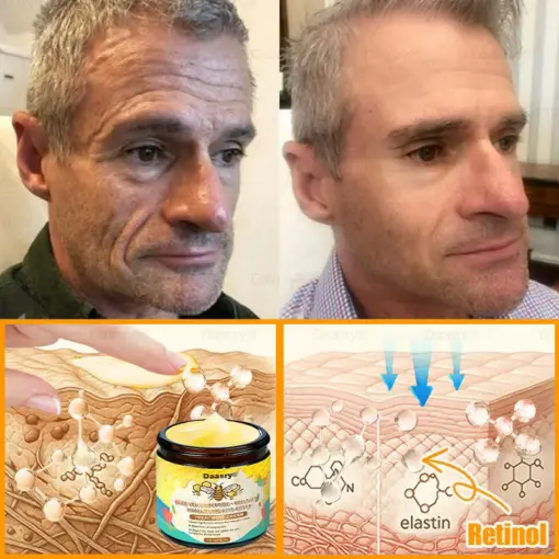 Daasry® Bee Venom Treatment Cream