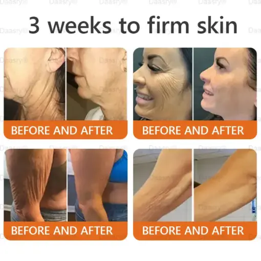 Daasry® Botox Bee Venom Skin Restoration Cream