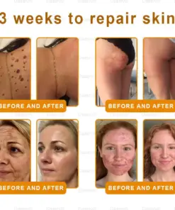 Daasry® Botox Bee Venom Skin Restoration Cream