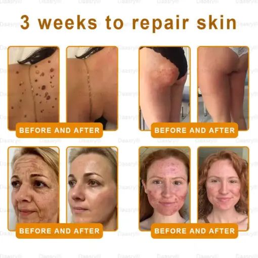 Daasry® Botox Bee Venom Skin Restoration Cream