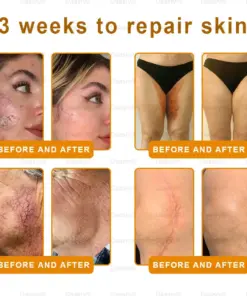 Daasry® Botox Bee Venom Skin Restoration Cream