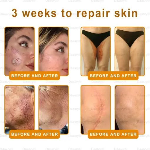 Daasry® Botox Bee Venom Skin Restoration Cream