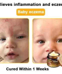 Daasry® Magnesium skin repair cream