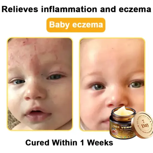 Daasry® Magnesium skin repair cream