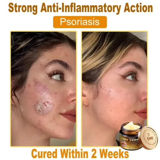 Daasry® Magnesium skin repair cream