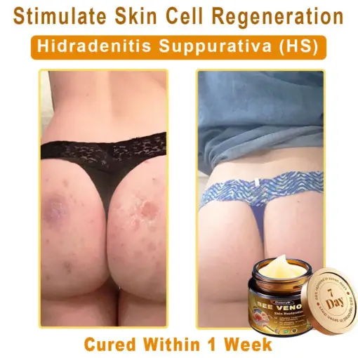 Daasry® Magnesium skin repair cream