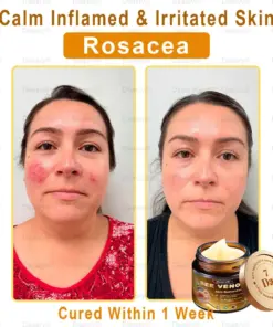 Daasry® Skin Repair Cream