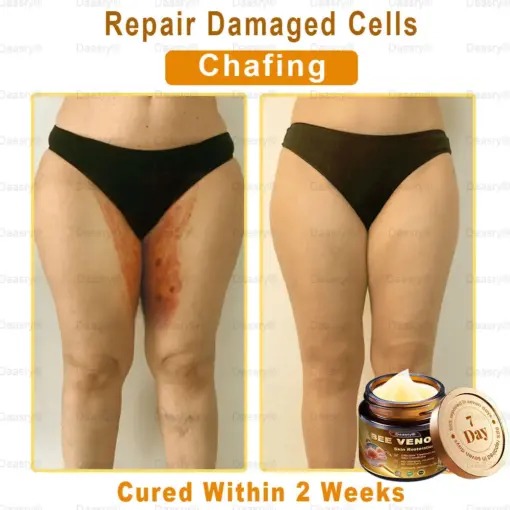 Daasry® Skin Repair Cream