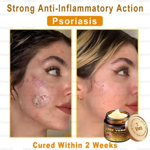 Daasry® Skin Repair Cream