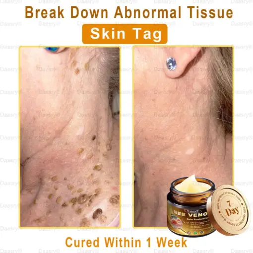 Daasry® Skin Repair Cream