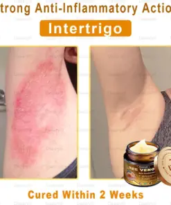 Daasry® Skin Repair Cream