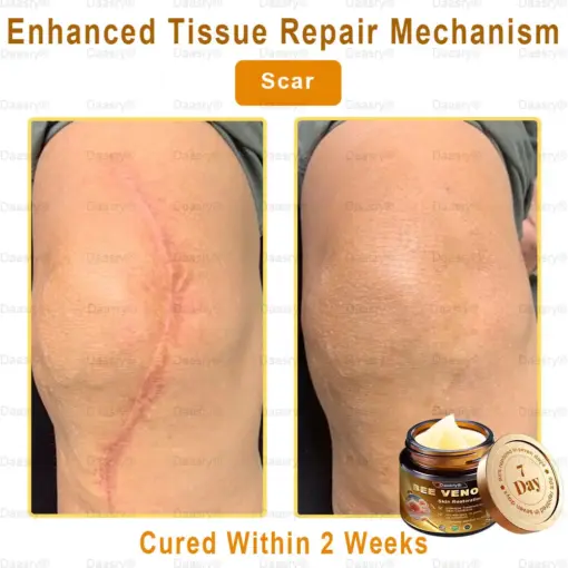 Daasry® Skin Repair Cream