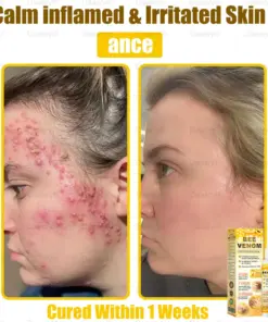 Daasry® Bee Venom Skin Restoration Spray