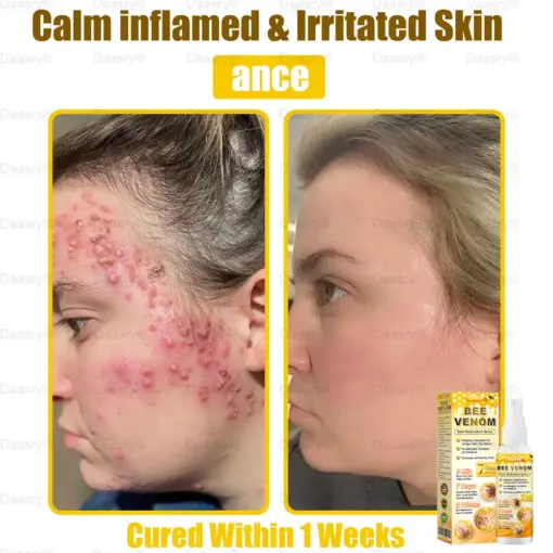 Daasry® Bee Venom Skin Restoration Spray