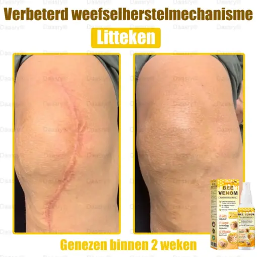 Daasry® Bee Venom Skin Restoration Spray
