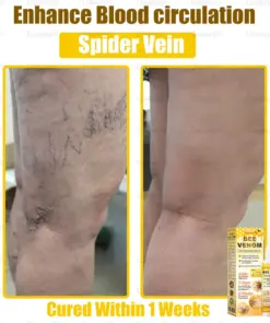 Daasry® Bee Venom Skin Restoration Spray