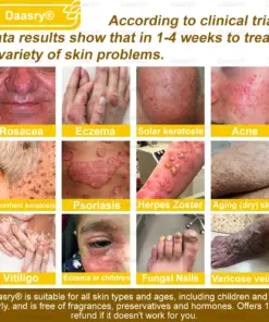 Daasry® Bee Venom Skin Restoration Spray