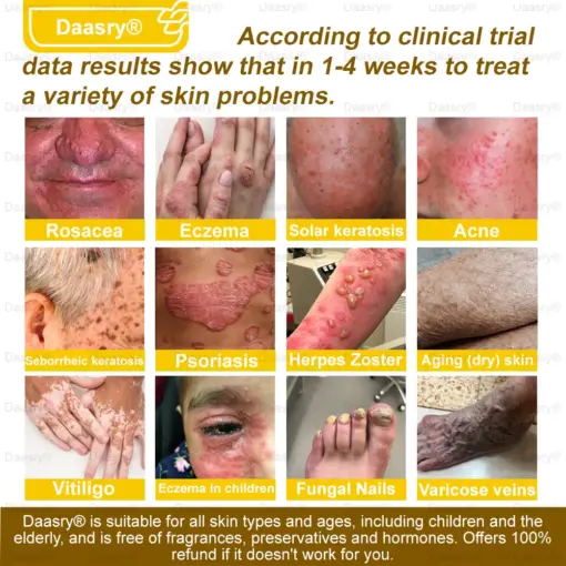 Daasry® Bee Venom Skin Restoration Spray