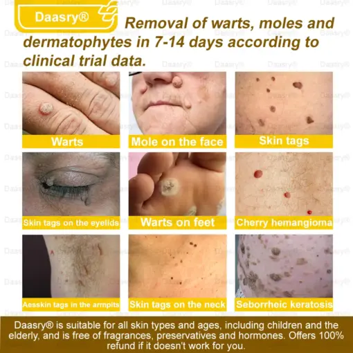 Daasry® Bee Venom Skin Restoration Spray