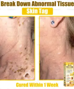 Daasry® Bee Venom Skin Restoration Spray