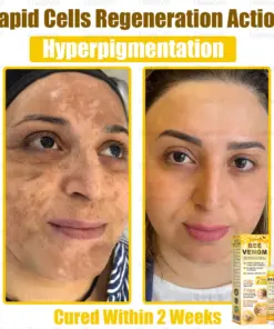 Daasry® Bee Venom Skin Restoration Spray