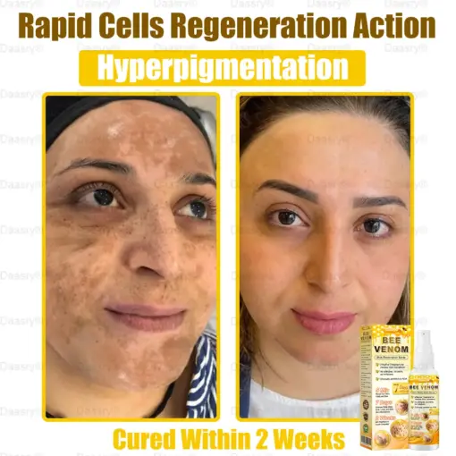 Daasry® Bee Venom Skin Restoration Spray