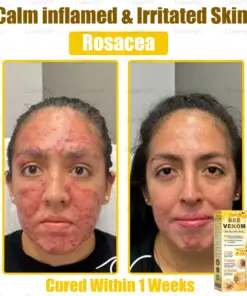 Daasry® Bee Venom Skin Restoration Spray