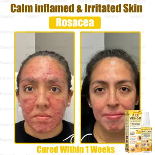 Daasry® Bee Venom Skin Restoration Spray
