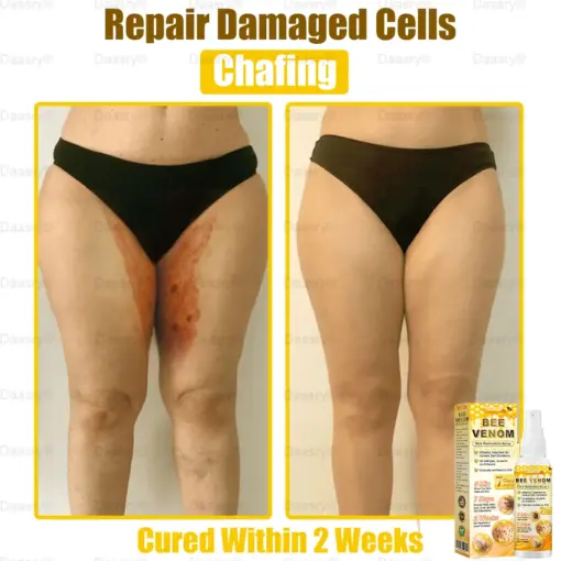 Daasry® Bee Venom Skin Restoration Spray