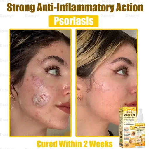 Daasry® Bee Venom Skin Restoration Spray