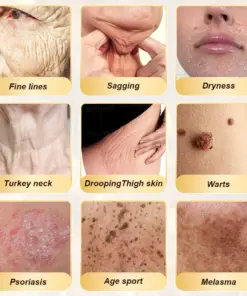 𝑫𝒂𝒂𝒔𝒓𝒚® 𝑩𝒆𝒆 𝑽𝒆𝒏𝒐𝒎 𝑺𝒌𝒊𝒏 𝑹𝒆𝒑𝒂𝒊𝒓 & 𝑨𝒏𝒕𝒊-𝑨𝒈𝒊𝒏𝒈 𝑪𝒓𝒆𝒂𝒎