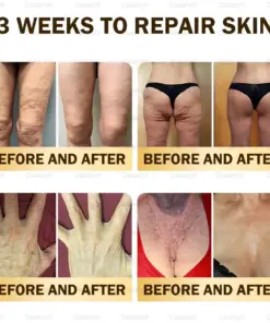 𝑫𝒂𝒂𝒔𝒓𝒚® 𝑩𝒆𝒆 𝑽𝒆𝒏𝒐𝒎 𝑺𝒌𝒊𝒏 𝑹𝒆𝒑𝒂𝒊𝒓 & 𝑨𝒏𝒕𝒊-𝑨𝒈𝒊𝒏𝒈 𝑪𝒓𝒆𝒂𝒎