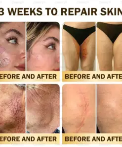 𝑫𝒂𝒂𝒔𝒓𝒚® 𝑩𝒆𝒆 𝑽𝒆𝒏𝒐𝒎 𝑺𝒌𝒊𝒏 𝑹𝒆𝒑𝒂𝒊𝒓 & 𝑨𝒏𝒕𝒊-𝑨𝒈𝒊𝒏𝒈 𝑪𝒓𝒆𝒂𝒎