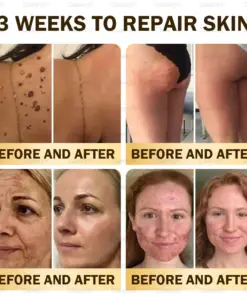 𝑫𝒂𝒂𝒔𝒓𝒚® 𝑩𝒆𝒆 𝑽𝒆𝒏𝒐𝒎 𝑺𝒌𝒊𝒏 𝑹𝒆𝒑𝒂𝒊𝒓 & 𝑨𝒏𝒕𝒊-𝑨𝒈𝒊𝒏𝒈 𝑪𝒓𝒆𝒂𝒎