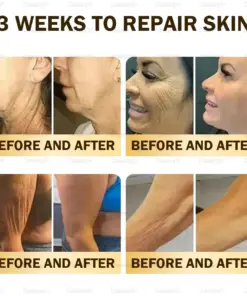 𝑫𝒂𝒂𝒔𝒓𝒚® 𝑩𝒆𝒆 𝑽𝒆𝒏𝒐𝒎 𝑺𝒌𝒊𝒏 𝑹𝒆𝒑𝒂𝒊𝒓 & 𝑨𝒏𝒕𝒊-𝑨𝒈𝒊𝒏𝒈 𝑪𝒓𝒆𝒂𝒎