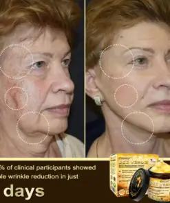 𝑫𝒂𝒂𝒔𝒓𝒚® 𝑩𝒆𝒆 𝑽𝒆𝒏𝒐𝒎 𝑺𝒌𝒊𝒏 𝑹𝒆𝒑𝒂𝒊𝒓 & 𝑨𝒏𝒕𝒊-𝑨𝒈𝒊𝒏𝒈 𝑪𝒓𝒆𝒂𝒎